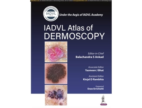 Livro Atlas of Dermoscopy de Balachandra S Ankad, Yasmeen J Bhat et al. (Inglês)