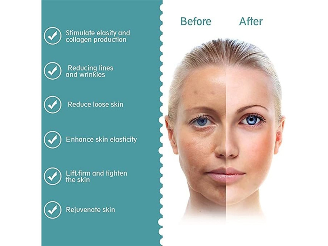 Massajador Facial Geração para Aquecimento Facial Máquina Facial Homens Mulheres Pescoço Queixo Olhos Braço Pernas Corpo Branco AUJEZON