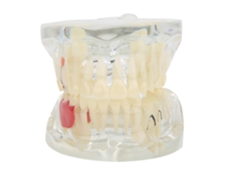 Modelo de Dentes Decíduos Patológicos para Ensino Odontológico Laboratório Hospital Instrumento Didático Resina Transparente