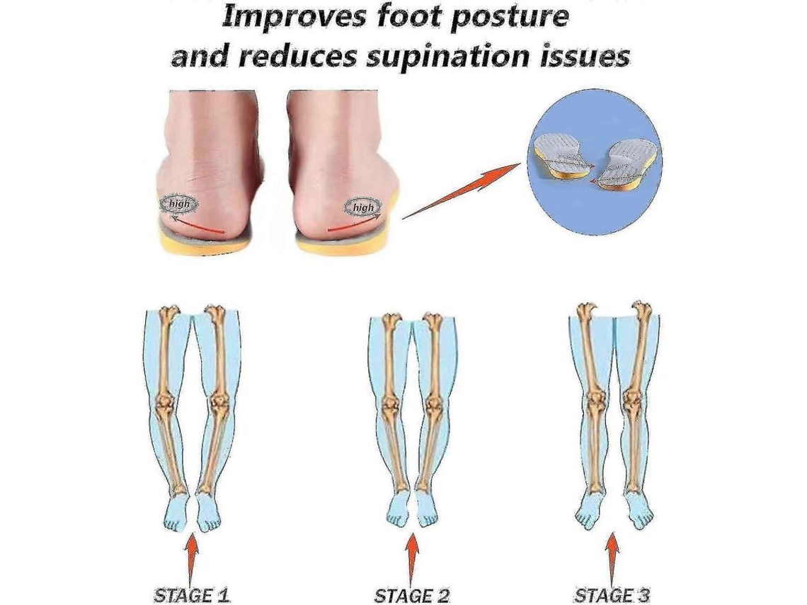 Insole para Supinação Excessiva e Suporte para Arco Alto, Inserto Ortopédico para Alinhamento do Pé