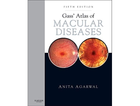 Livro Gass Atlas of Macular Diseases de Anita Agarwal Md (Inglês)