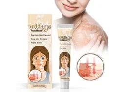 Crema Herbal Para Vitiligo Com Manchas Brancas Piebald 20g Regula A Pigmentação E Protege A Pele