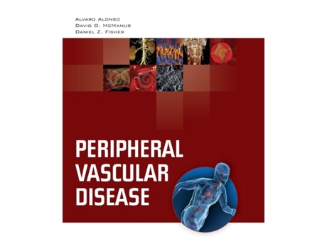 Livro Peripheral Vascular Disease Alvaro Alonso, Daniel D. McManus et al. (Inglês)