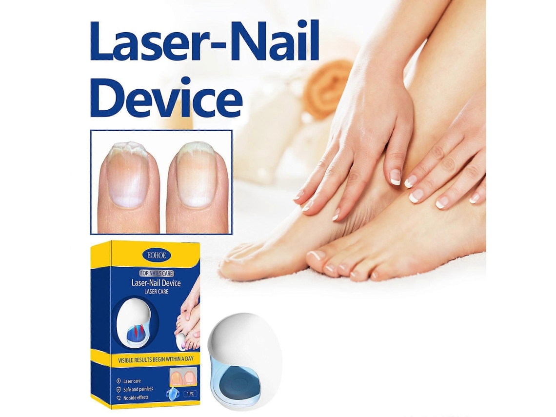 Dispositivo de Tratamento a Laser Fungos Unhas para Dos Pés e Onicomicose, Un Has U GOKOCO