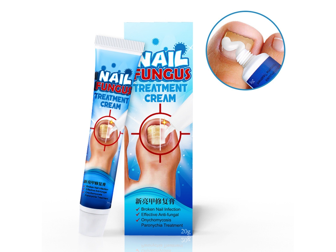 Creme Para Fungo De Unha 20g - Remove Fungo De Unha Do Pé E Mão - Fácil De Aplicar