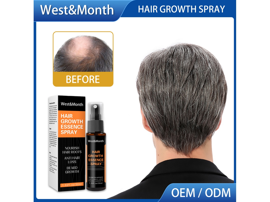 Spray De Crescimento Capilar Westmonth 30ml - Nutrição Para Couro Cabeludo, Reparo E Cuidado Com Os Cabelos