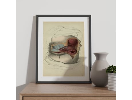 Pôster De Dissecção De NACNIC Perineum Ilustrações Decorativas De Anatomia E Medicina Em Estilo Vintage Tamanho A3 Com Armação Branca