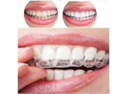 Mais Vendido em 2024 Aparelho de Silicone de 12 Pacotes para Proteção do Sono Contra Ranger de Dentes À Noite TAISHENGDA