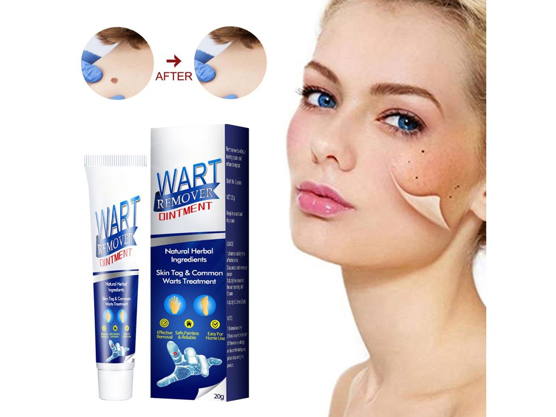 Creme Para Remoção De Marcas Cutâneas E Verrugas Eficaz