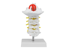 Yuru modelo Anatomico Coluna Cervical Humana 1:1 com Artérias e Nervos para Laboratório Científico e Ensino Médico