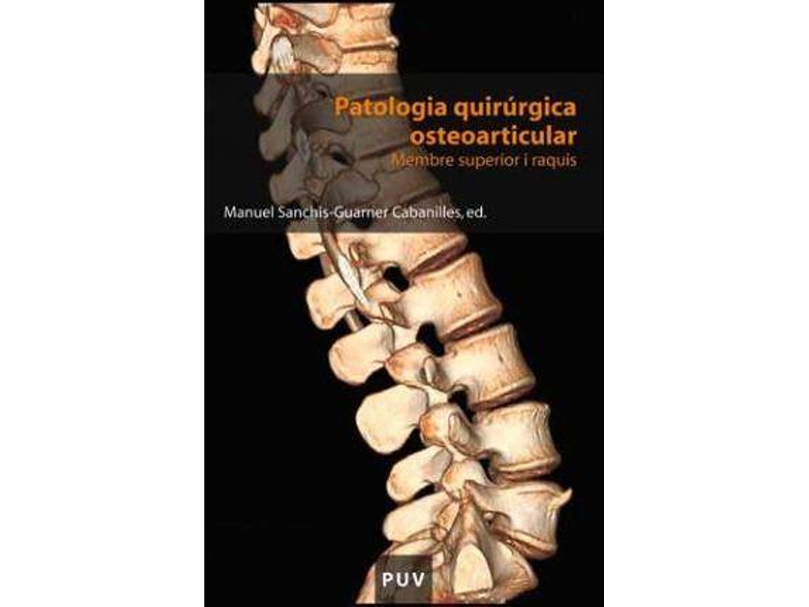 Livro Patología quirúrgica osteoarticular membre superior i raquis de Carlos Barrios Pitarque, Luis Gil Santos et al. (Espanhol)