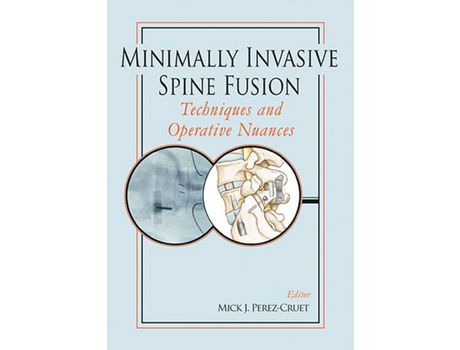 Livro Livro Minimally Invasive Spine Fusion: Techniques and Operative Nuances de Vários Autores (Inglês) de Mick Perez Cruet, Rudolf Beisse, Luiz Pimenta, Daniel Kim ( Inglês )