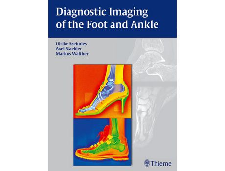 Livro Livro Diagnostic Imaging of the Foot and Ankle de Vários Autores (Inglês) de Ulrike Szeimies, Axel Stabler, Markus Walther, Ulrike Szeimies ( Inglês )