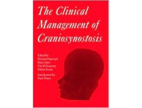 Livro The Clinical Management of Craniosynostosis de Richard Hayward Barry Jones David Dunaway Robert Evans (Inglês)