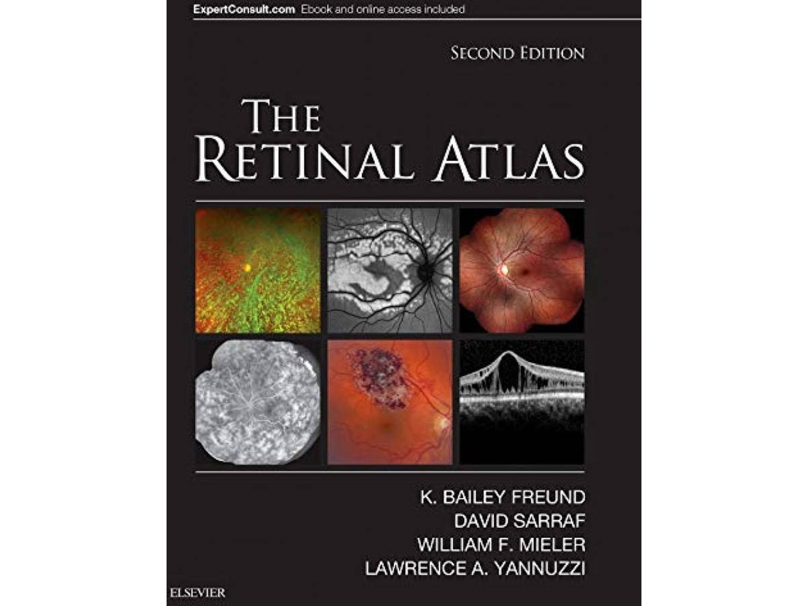 Livro The Retinal Atlas (Inglês)