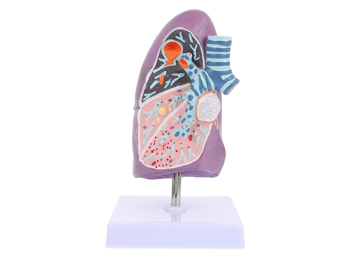 Plástico E Educação Pulmonar Fumante