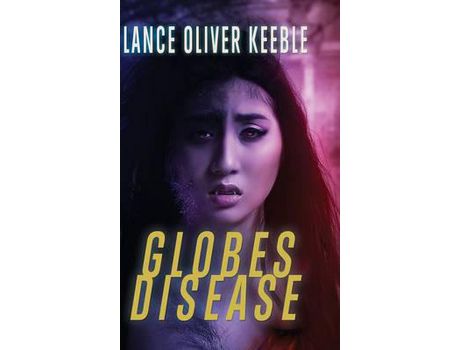 Livro Globes Disease de Lance Oliver Keeble ( Inglês )