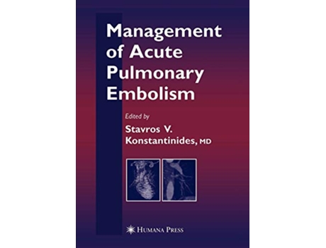 Livro Management of Acute Pulmonary Embolism de Stavros V Konstantinides e Sz Goldhaber (Inglês)
