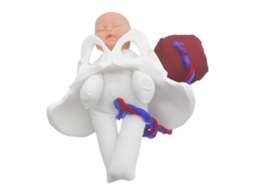 Modelo Anatômico Em Pvc Da Pelve Durante A Gravidez, Com Placenta E Cordão Umbilical.