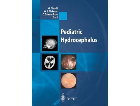 Livro pediatric hydrocephalus de edited by g cinalli , edited by w j maixner , edited by c sainte rose (inglês)