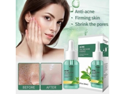 Sérum Facial Hidratante Antiacne Com Óleo De Melaleuca, Tratamento Facial Para Controle Da Acne.