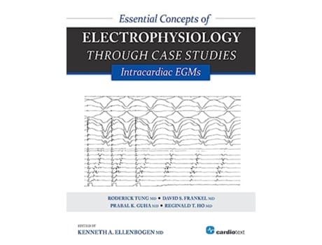 Livro Essential Concepts of Electrophysiology through Case Studies Intracardiac EGMs de Kenneth A Ellenbogen (Inglês)