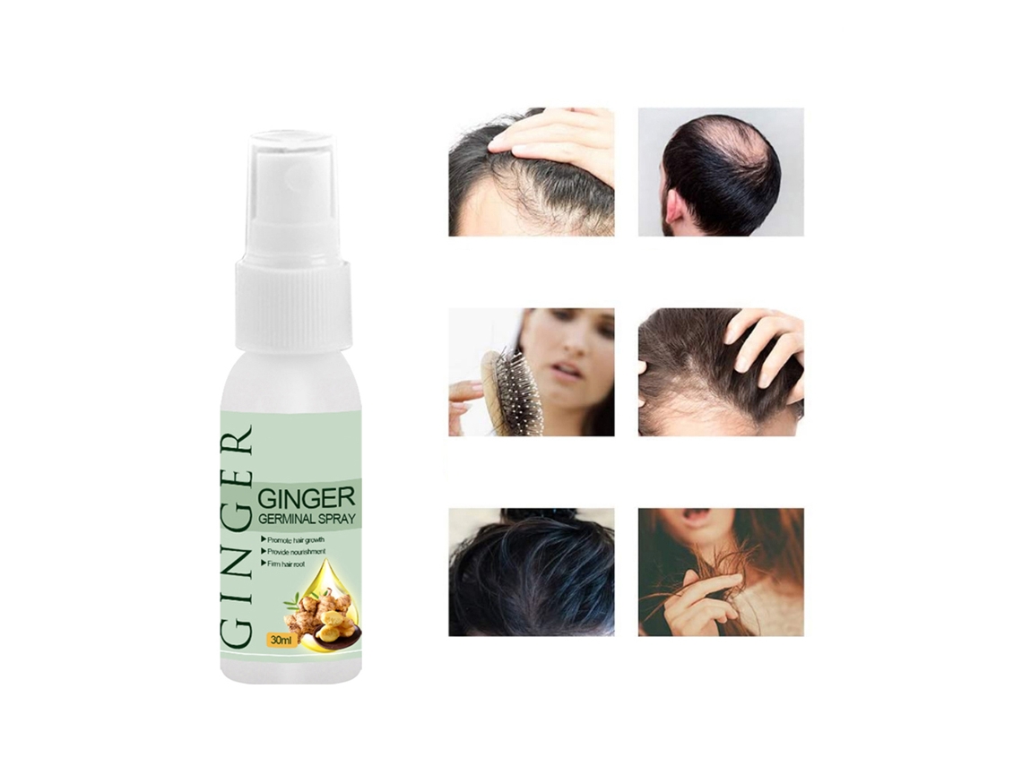 30ml Serum Spray Para Crecimiento De Cabello Anti Caída De Cabello Para Hombres Y Mujeres