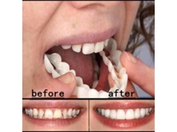 CD04424-Prótese Branca para Sorriso - Capa Cosmética para Dentes Postiços YWEI