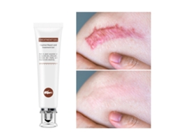 Creme Para Cicatrizes E Marcas De Estirpe Não Irritante