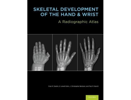 Livro Skeletal Development of the Hand and Wrist de Cree M Gaskin, Md Mba S Lowell Kahn et al. (Inglês - Capa Dura)