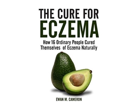 Livro The Cure for Eczema de Ewan M Cameron (Inglês - Capa Dura)