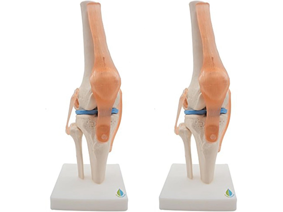 Modelo Anatômico 2x da Articulação do Joelho com Ligamentos. SFUSHOS