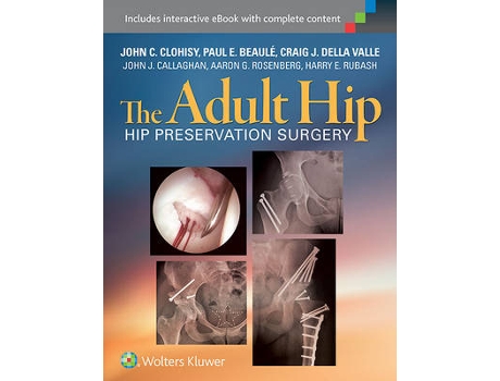 Livro Adult Hip de John Clohisy Md, Paul Beaule Md et al. (Inglês - Capa Dura)