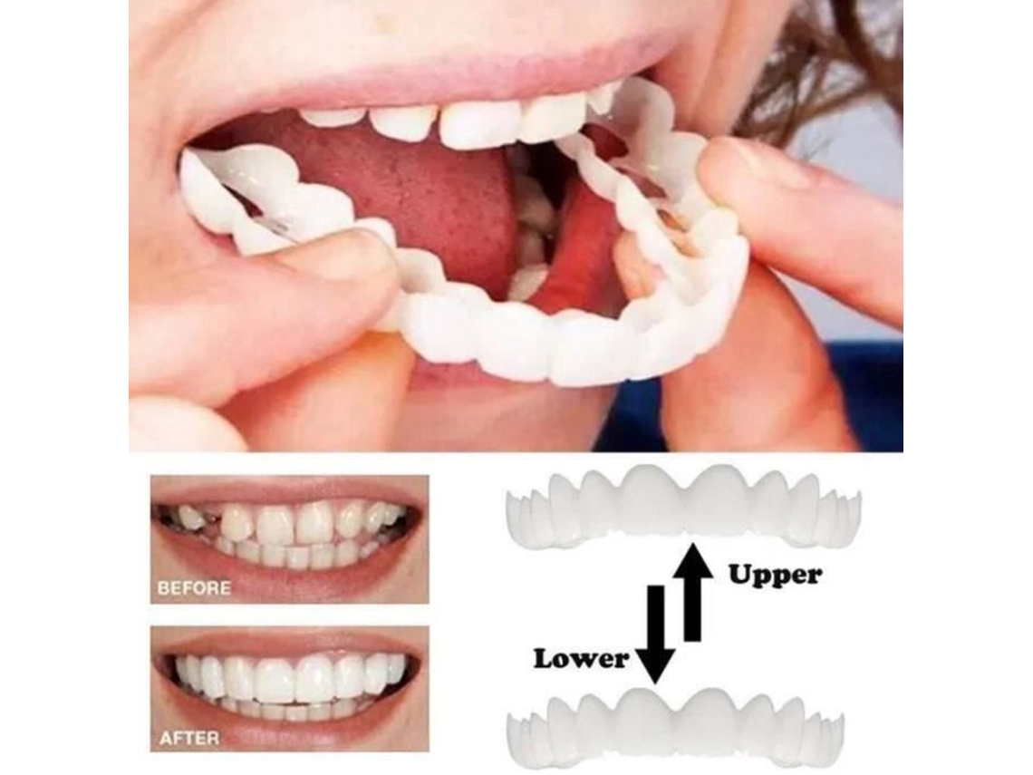 ZG02940-1 par dentaduras dentes superiores cosméticos conforto flexível dentaduras kit dente falso simulado chaves YWEI