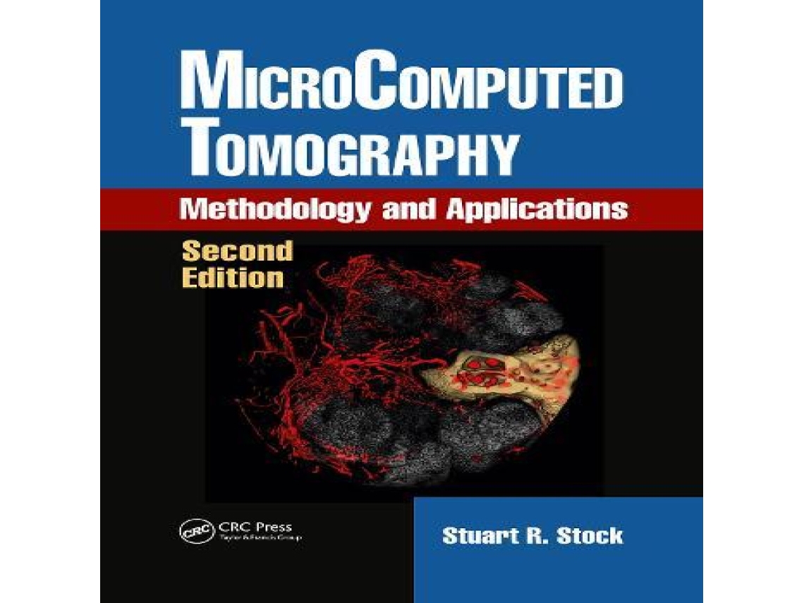 Livro MicroComputed Tomography de Stock e Stuart R (Inglês)