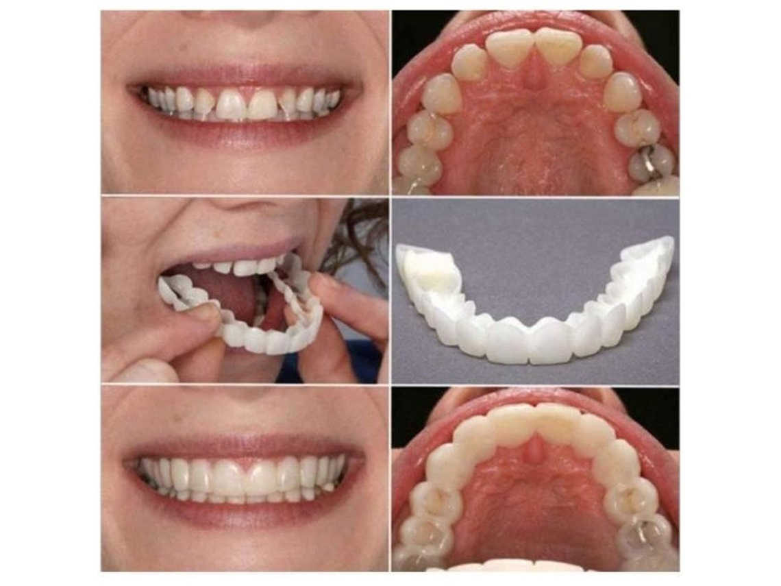 2 conjuntos de dentaduras de silicone, parte superior e inferior, sorriso perfeito para homens e mulheres, dentes falsos naturais removíveis, temporár