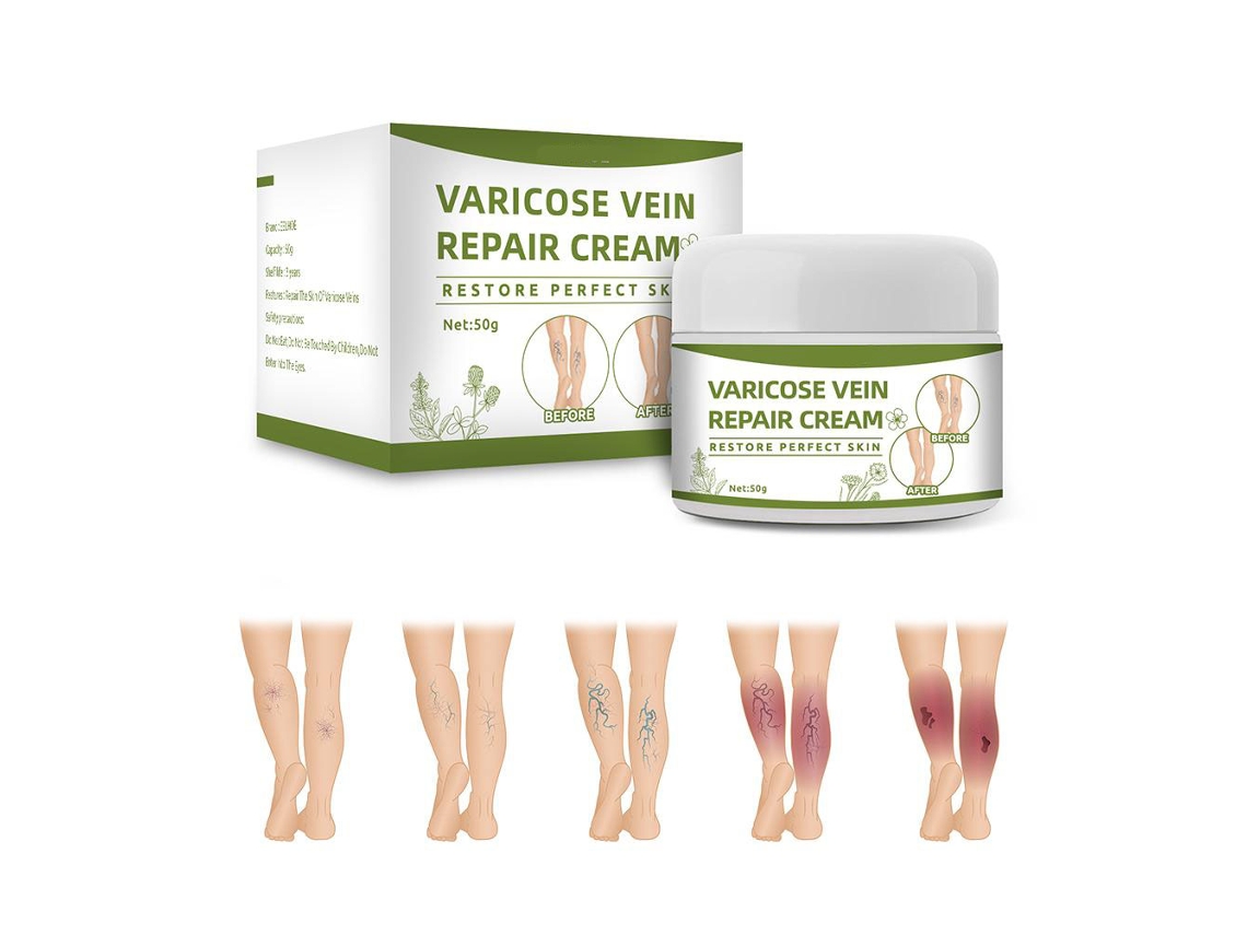 Creme Para Varizes Natural Creme Para Remoção De Varizes E Veias Da Aranha