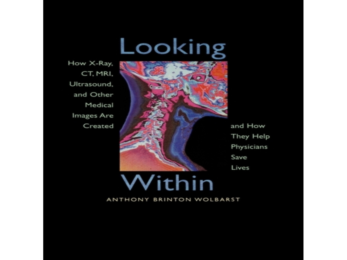 Livro Looking Within de Anthony Brinton Wolbarst (Inglês)