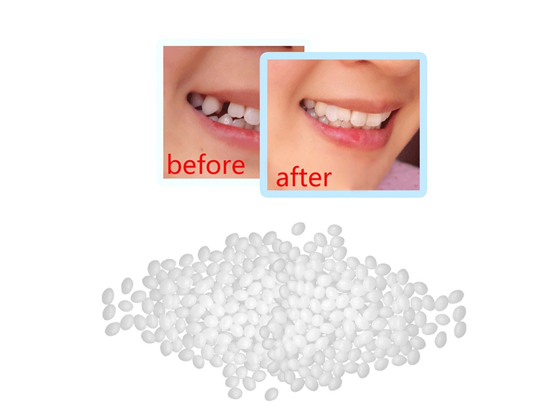 Dentes Falsos Com Presas Kit De Dentaduras Temporárias Para Halloween Cola Para Dentaduras E Preenchimento