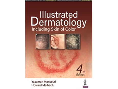 Livro Illustrated Dermatology De Yasaman Mansouri E Howard Maibach (inglês - Capa Dura)