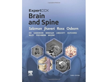 Livro ExpertDDx Brain and Spine de Karen L Salzman Md, Miral D Jhaveri Md Mba et al. (Inglês - Capa Dura)