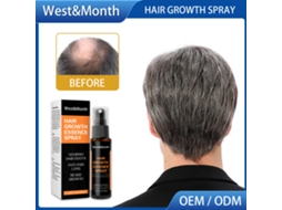 Spray De Crescimento Capilar Westmonth 30ml - Nutrição Para Couro Cabeludo, Reparo E Cuidado Com Os Cabelos