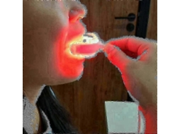 Terapia de Luz Vermelha para o Mais Novo Modelo Tratamento Feridas Dentárias 2025, Aliviando a Gengivite com T Ecnologia Led GOKOCO