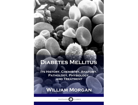 Livro Diabetes Mellitus Its History, Chemistry, Anatomy, Pathology, Physiology, And Treatment De Morgan, William Et Al. (inglês)