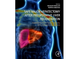 Livro Safe Major Hepatectomy After Preoperative Liver Regeneration De Yoshihiro Sakamoto E Masatoshi Makuuchi (inglês)