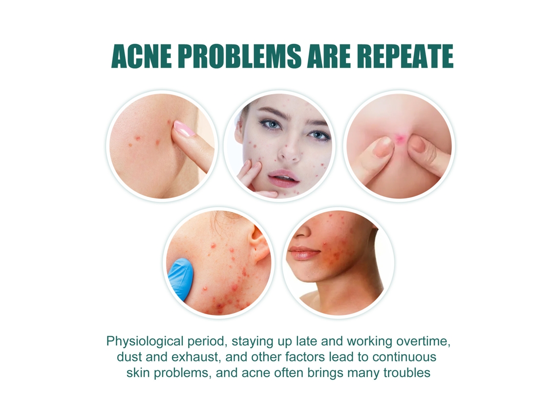 Adesivos Para Remoção De Acne E Cuidado Com A Pele