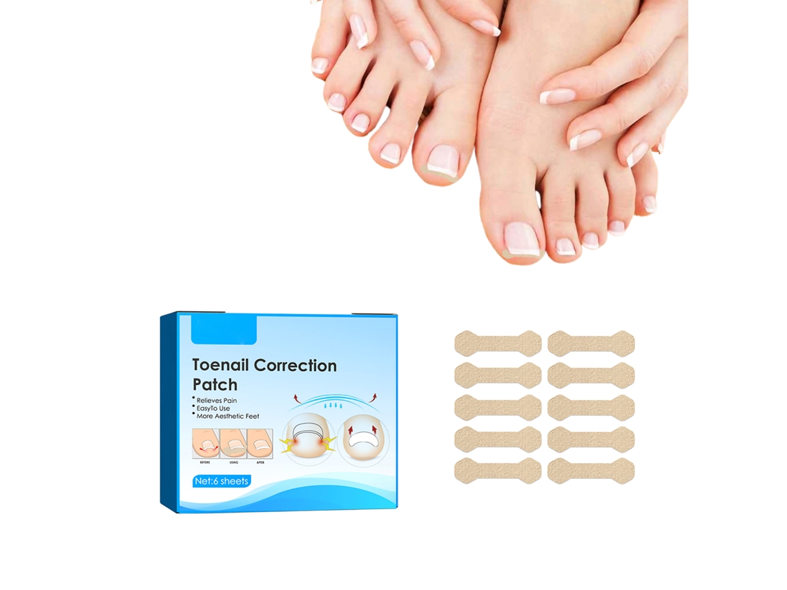 Adesivos corretores de unha encravada, ferramenta para correção de unhas, ferramentas para pedicure