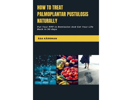 Livro How To Treat Palmoplantar Pustulosis Naturally Put Your Ppp In Remission And Get Your Life Back In 90 Days De Åsa Kärrman (inglês)
