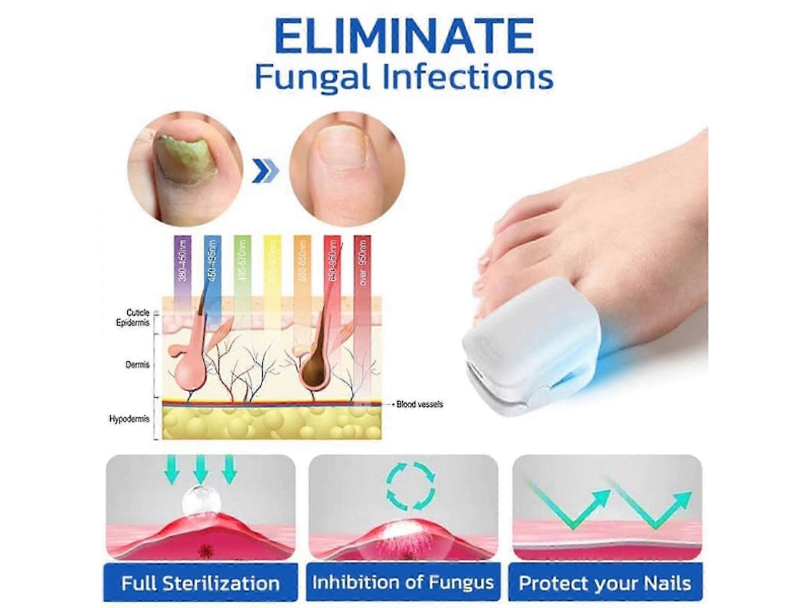 Zengo 2024 Novo Dispositivo de Limpeza Fungos Unhas, Terapia Unhas Luz Azul para Grossas Descolorida S Danificadas Das Mão GOKOCO