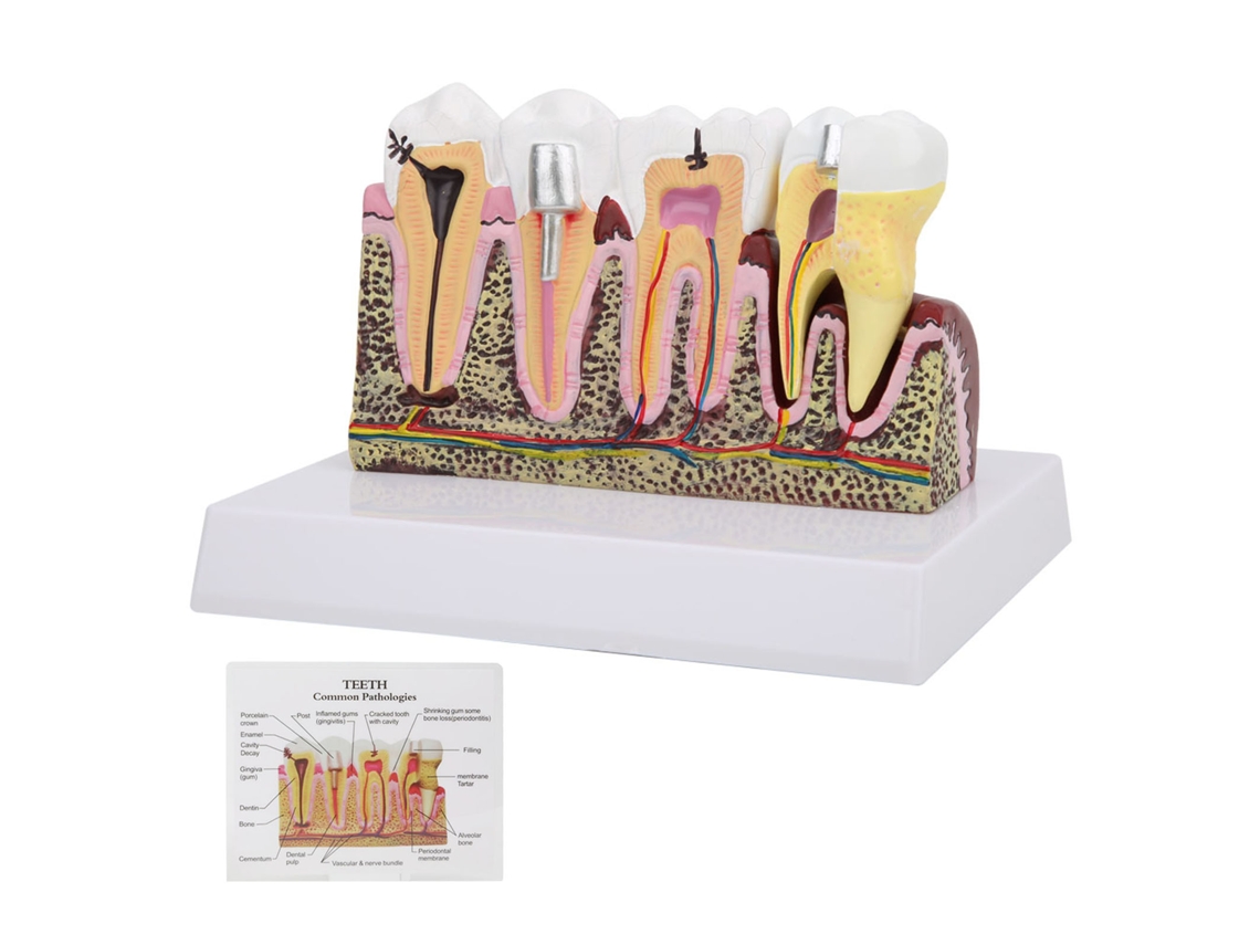 Modelo Anatomico de Dentes Odontologico | S/MARCA
